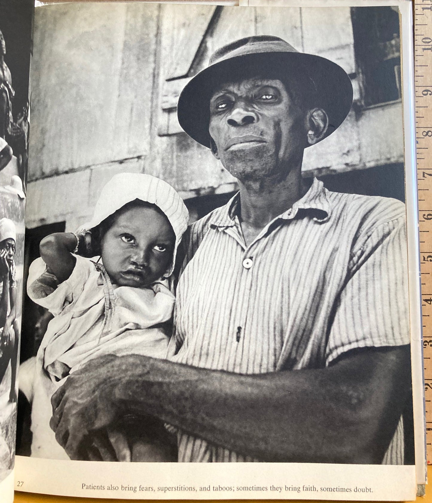 Anderson, Erica. The World of Albert Schweitzer. A Book of Photographs by Erica Anderson.